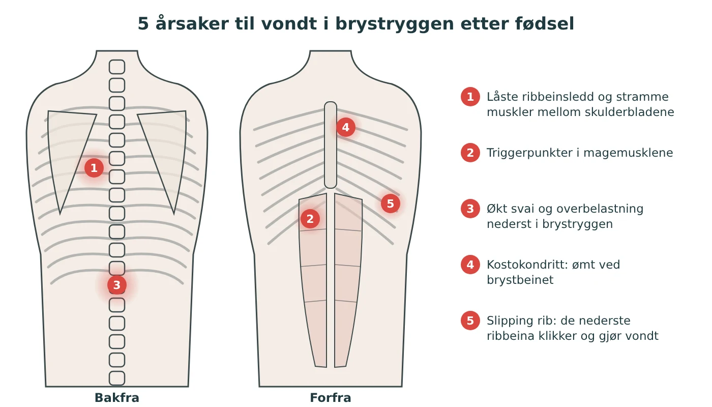 Illustrasjon av overkroppen bakfra og forfra med fem nummererte smertesteder: mellom skulderbladene, øverst i magemusklene, nederst i brystryggen, ved brystbeinet og nederst på ribbeina foran