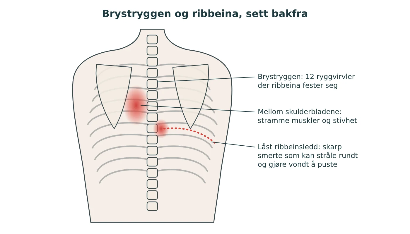 Illustrasjon av ryggen bakfra med brystryggen, ribbeina og skulderbladene, og typiske steder for smerter mellom skulderbladene og langs ribbeina