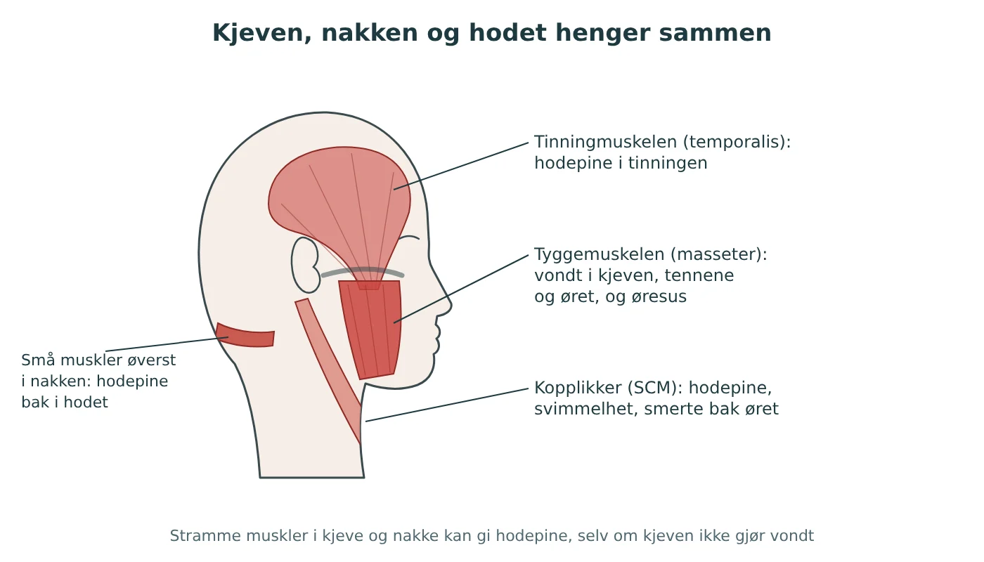 Illustrasjon av hodet fra siden med tinningmuskelen, tyggemuskelen, kopplikkeren og musklene øverst i nakken